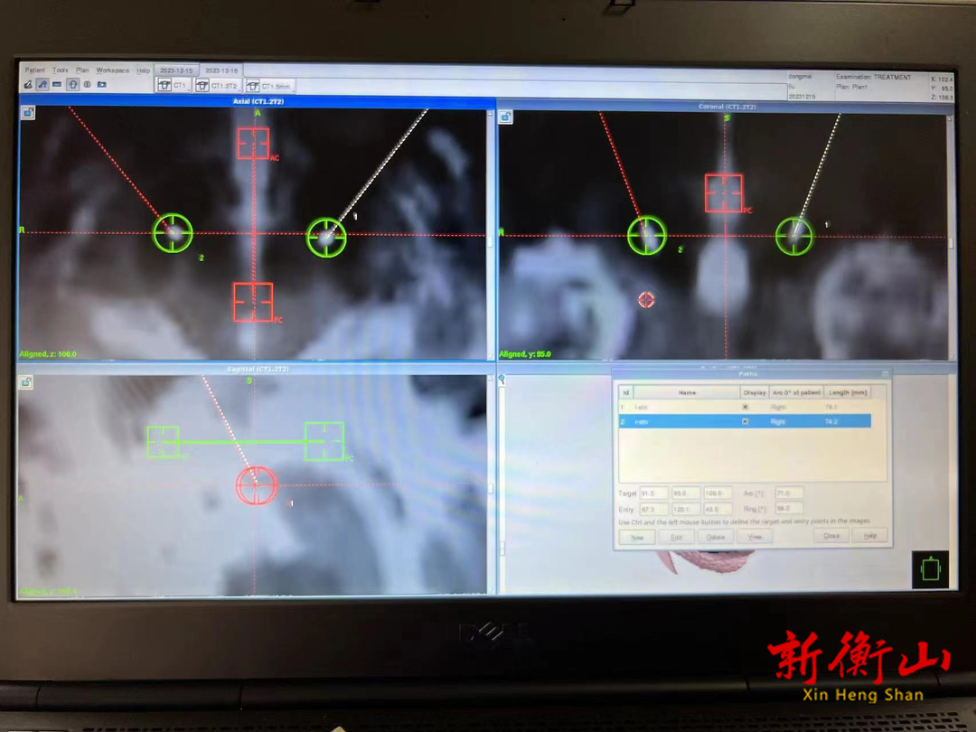 “帕”友不“怕”，南华医院成立帕金森病多学科诊疗中心